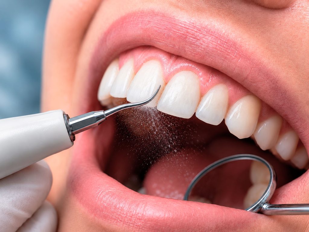 Tratamientos dentales
