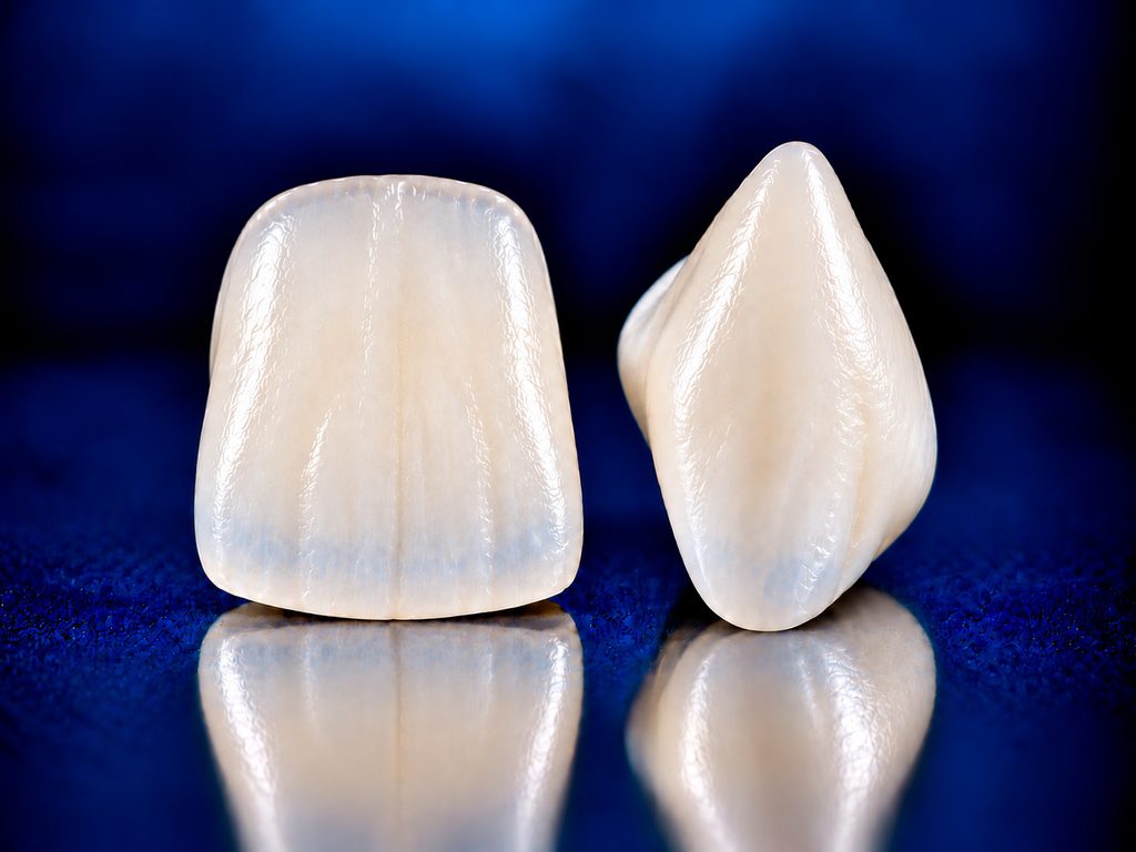 Tratamientos dentales