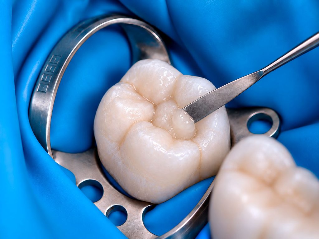 Tratamientos dentales